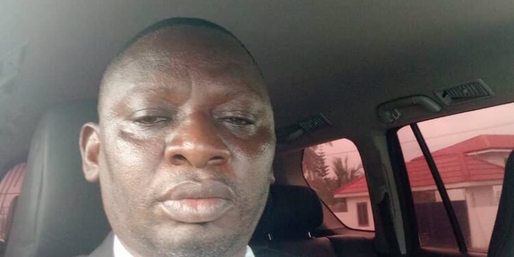 Health:upgrade the Kintampo Municipal Hospital to a Teaching hospital, Kintampo North MP