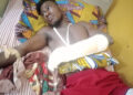 23-year old farmer cutlassed by Fulani herdsman at Damongo