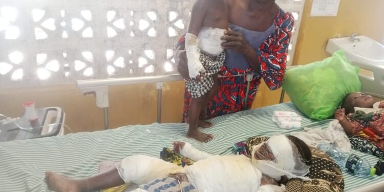 MP Abu Jinapor Assists Damongo fire Accident siblings, Covers Referral Costs.