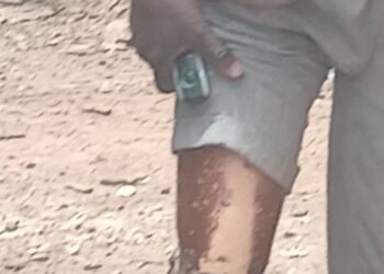 Disaster: Fire Razes 21 Homes at Singa in North Gonja District; Victims Appeal for Support